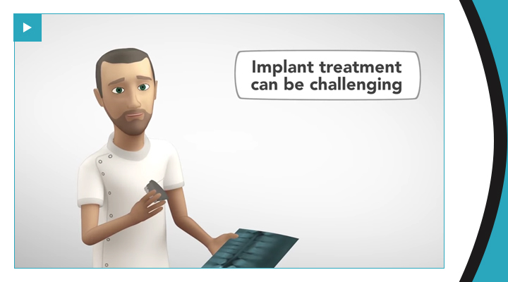 Implantology the digital way by 3Shape